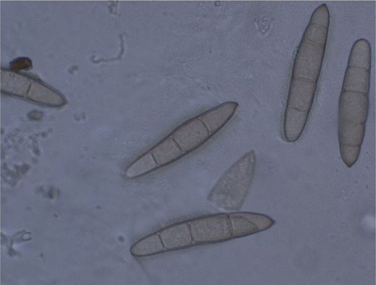 Spore di Exserohilum turcicum, agente dell'elmintosporiosi del mais