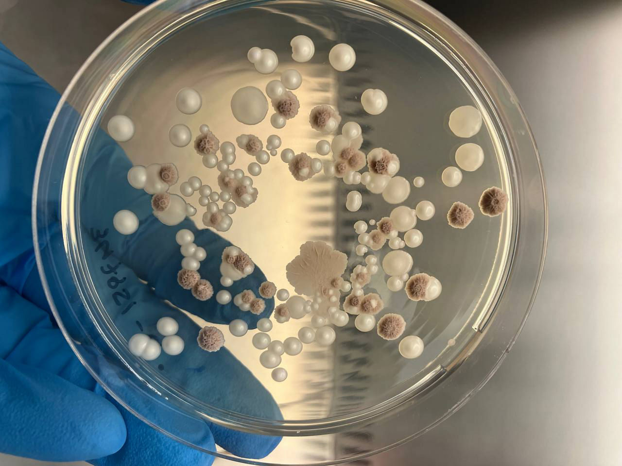 Dati analitici del laboratorio microbiologico Pioneer